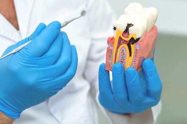 paslauga-endodontija